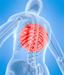 Невралгия, болки в гърба - Artrovex